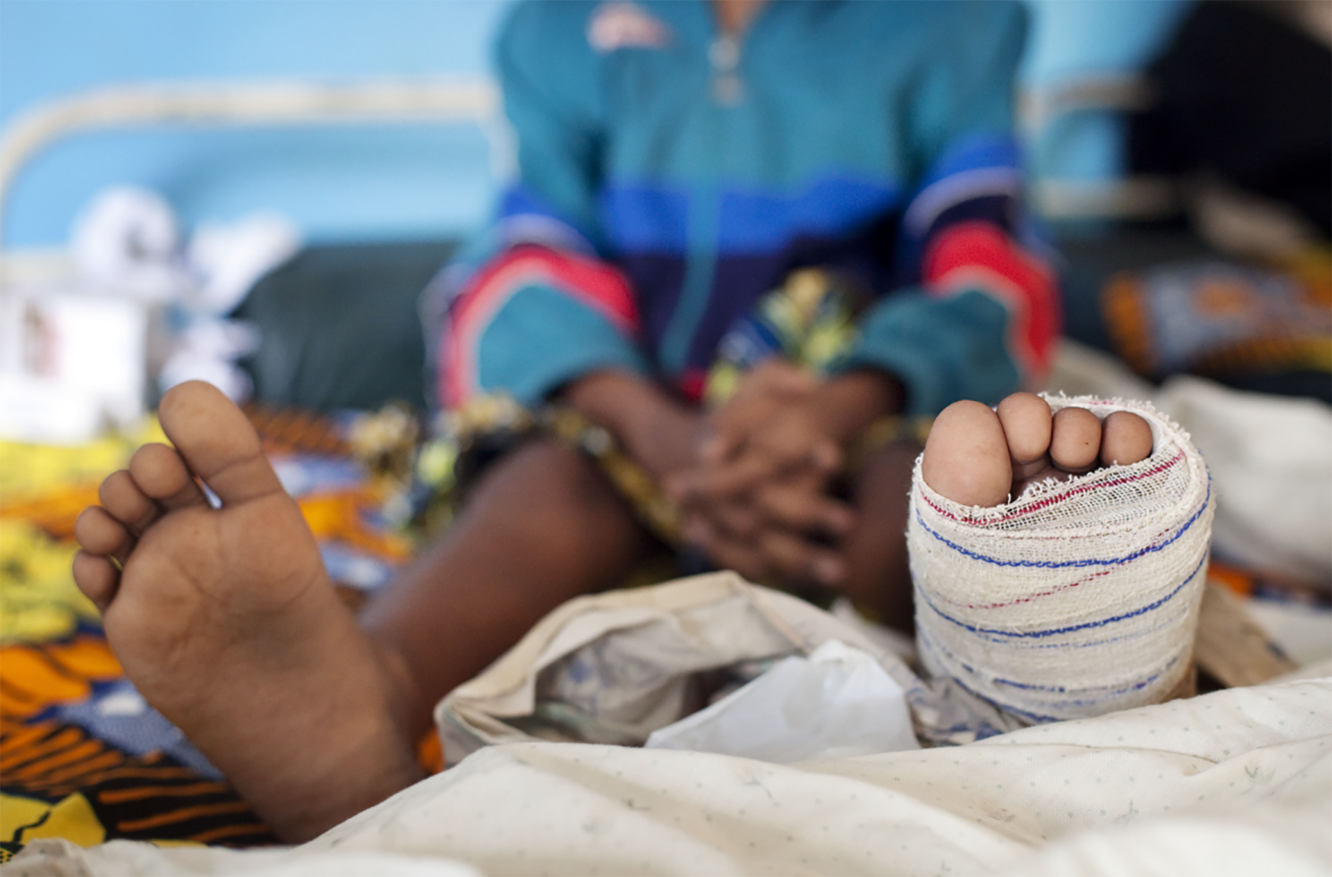 Buruli Ulcer patient under treatment
