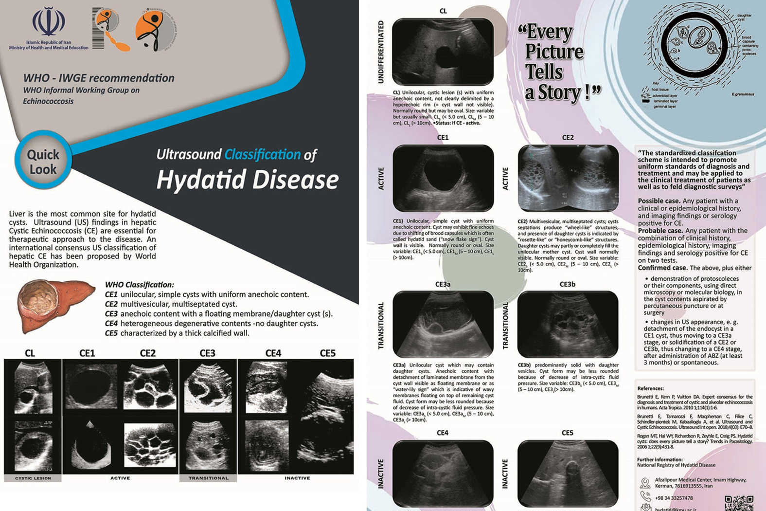 Professional education to improve diagnosis and treatment of CE – Posters with cyst classification guidance promote evidence-based diagnosis and treatment of CE