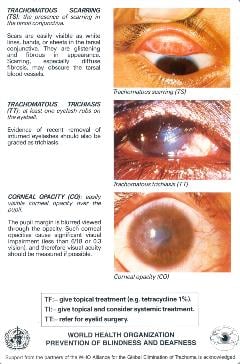 Trachoma-simplified-grading-card-verso-Eng